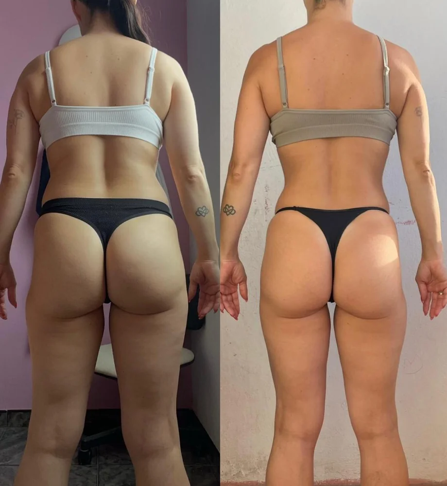 Client before and after transformation 8, within 12 weeks