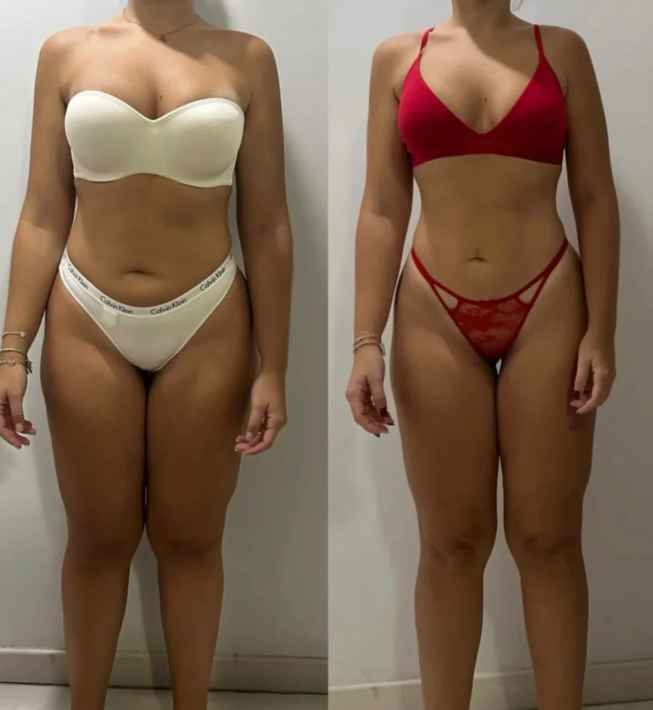 Client before and after transformation 9, within 12 weeks