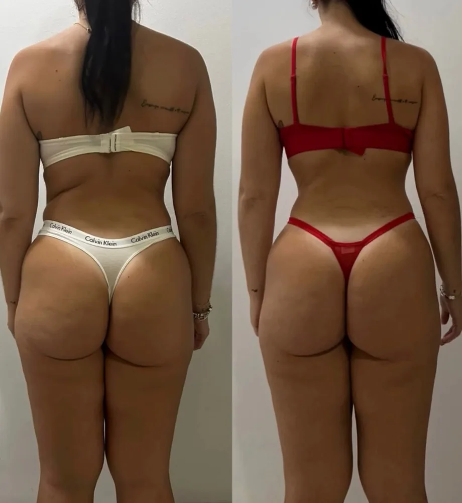 Client before and after transformation 10, within 12 weeks
