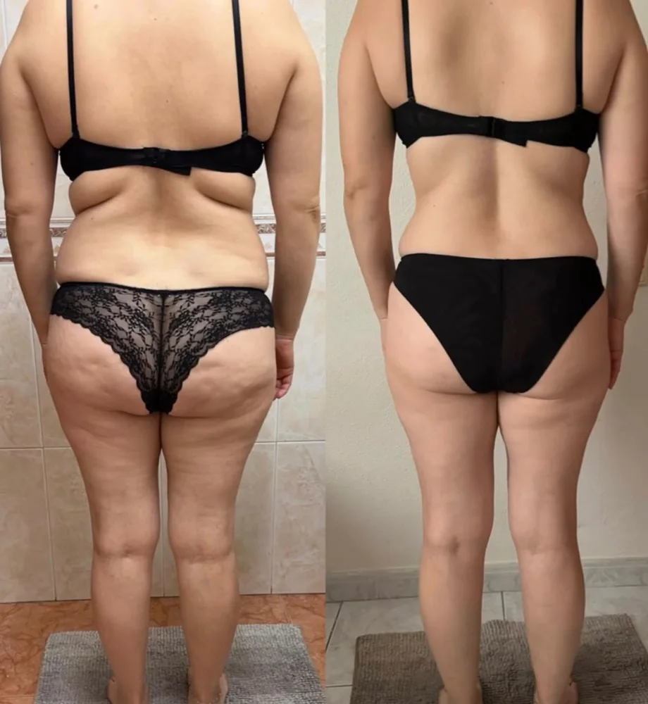 Client before and after transformation 14, within 12 weeks